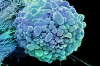 fda_clears_first_cancer_drug_based_on_genetics